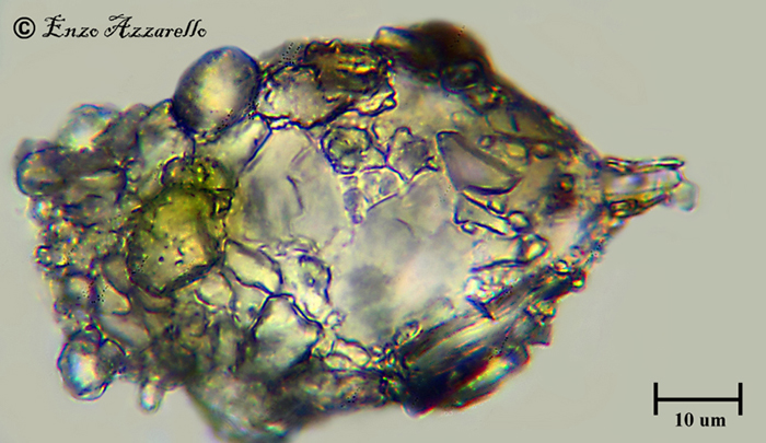 Difflugia 1000X
